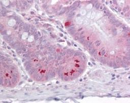 Immunohistochemistry-Paraffin: SETD7/9 Antibody [NB100-56664] - Analysis of human small instestine using SETD7 antibody at 1:100.