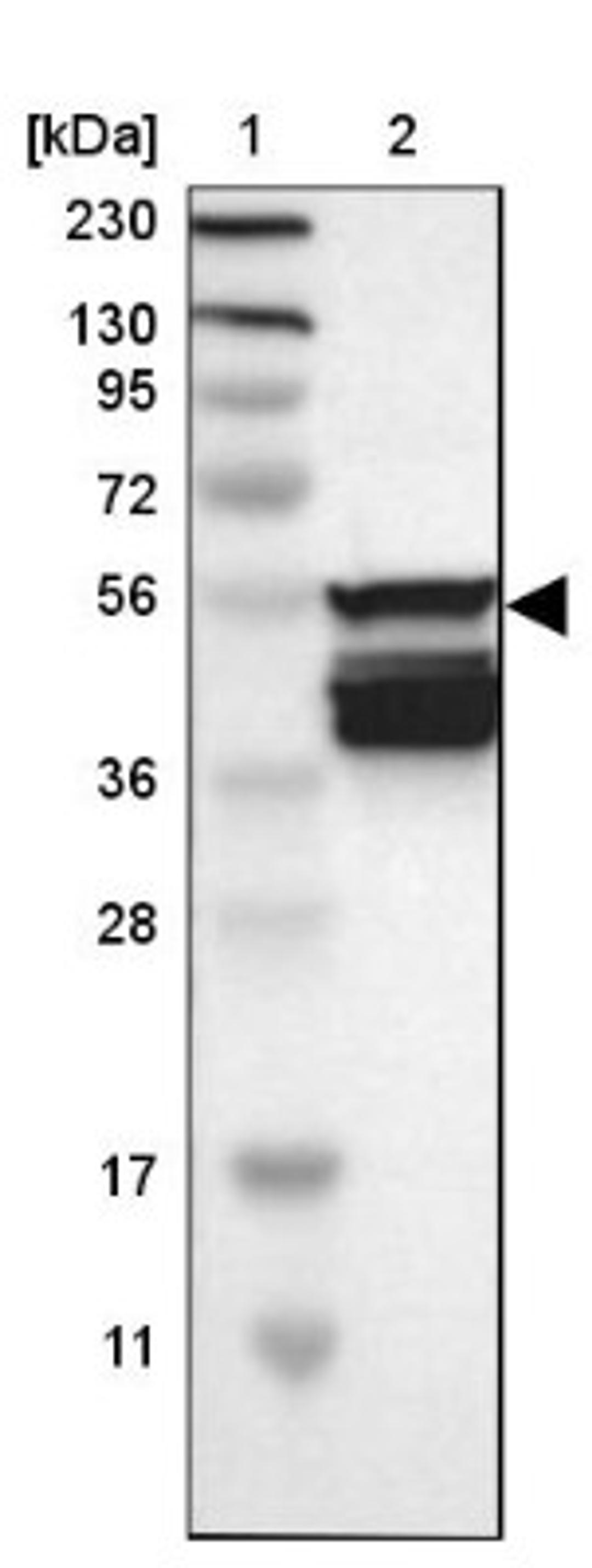 Western Blot: SLC22A2 Antibody [NBP1-89417] - Lane 1: Marker [kDa] 230, 130, 95, 72, 56, 36, 28, 17, 11<br/>Lane 2: Human cell line RT-4