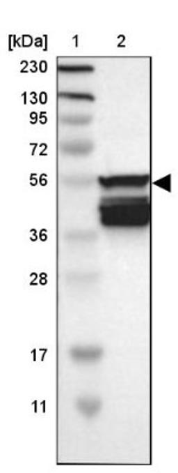 Western Blot: SLC22A2 Antibody [NBP1-89417] - Lane 1: Marker [kDa] 230, 130, 95, 72, 56, 36, 28, 17, 11<br/>Lane 2: Human cell line RT-4