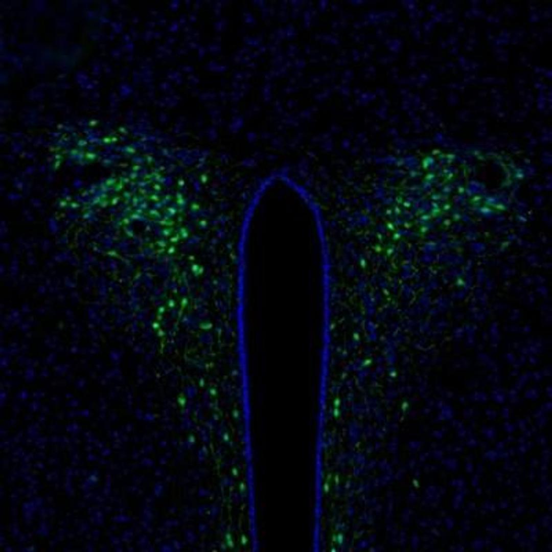 Immunocytochemistry/Immunofluorescence: Secretagogin Antibody [NBP1-88219] - Analysis of mouse hypothalamus shows selective positivity in the paraventricular nucleus.