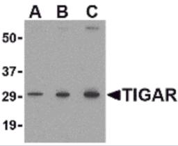 Western blot analysis of TIGAR in MCF7 cell lysate with TIGAR antibody at (A) 0.5, (B) 1 and (C) 2 &#956;g/mL.