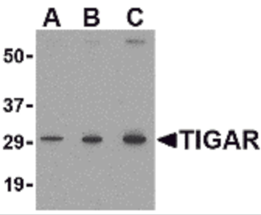 Western blot analysis of TIGAR in MCF7 cell lysate with TIGAR antibody at (A) 0.5, (B) 1 and (C) 2 μg/mL.