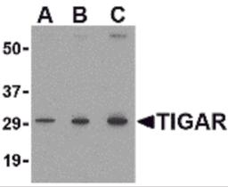 Western blot analysis of TIGAR in MCF7 cell lysate with TIGAR antibody at (A) 0.5, (B) 1 and (C) 2 μg/mL.