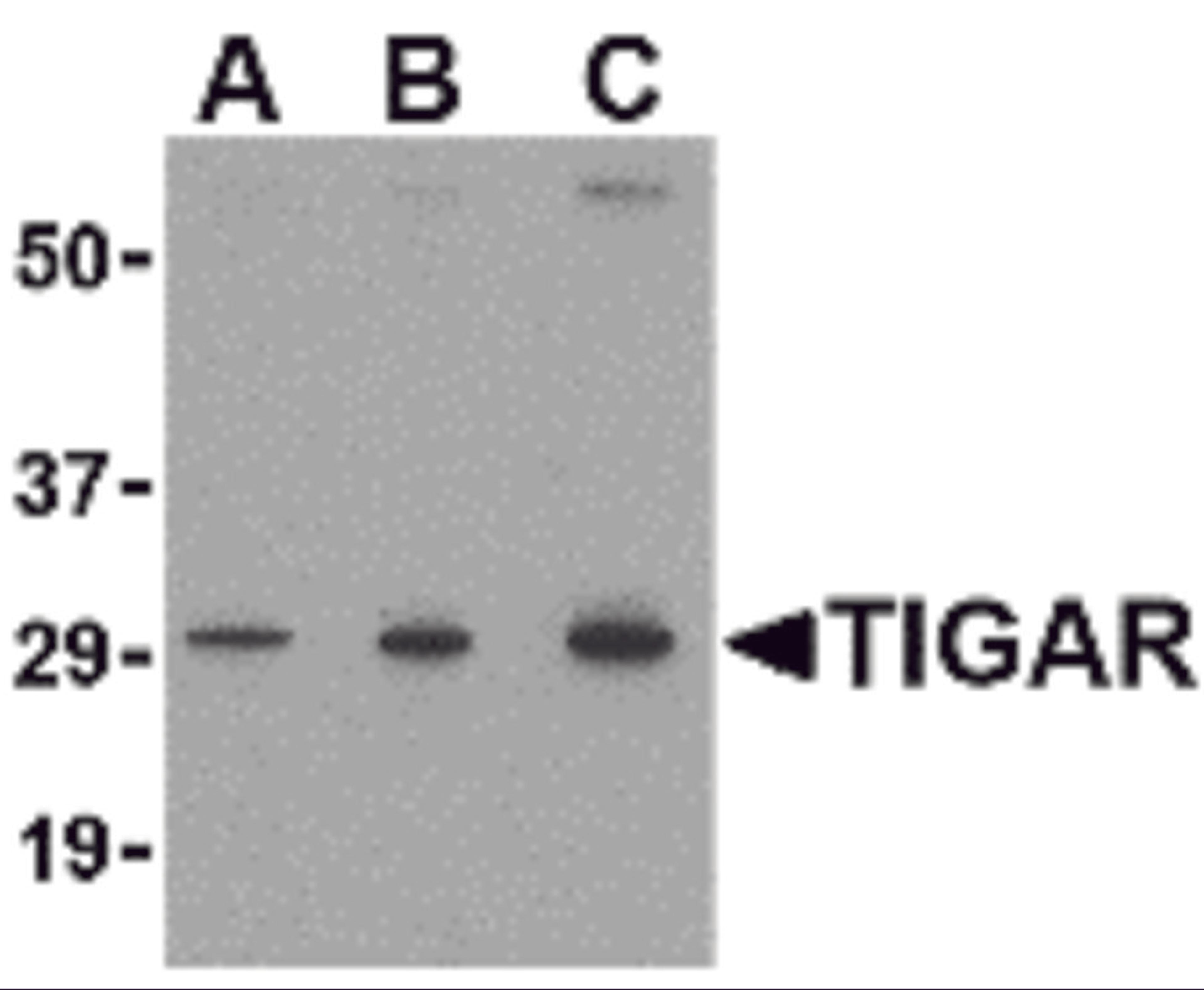 Western blot analysis of TIGAR in MCF7 cell lysate with TIGAR antibody at (A) 0.5, (B) 1 and (C) 2 μg/mL.