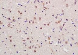 Immunohistochemical analysis of formalin-fixed paraffin embedded rat brain tissue using RGC32 antibody