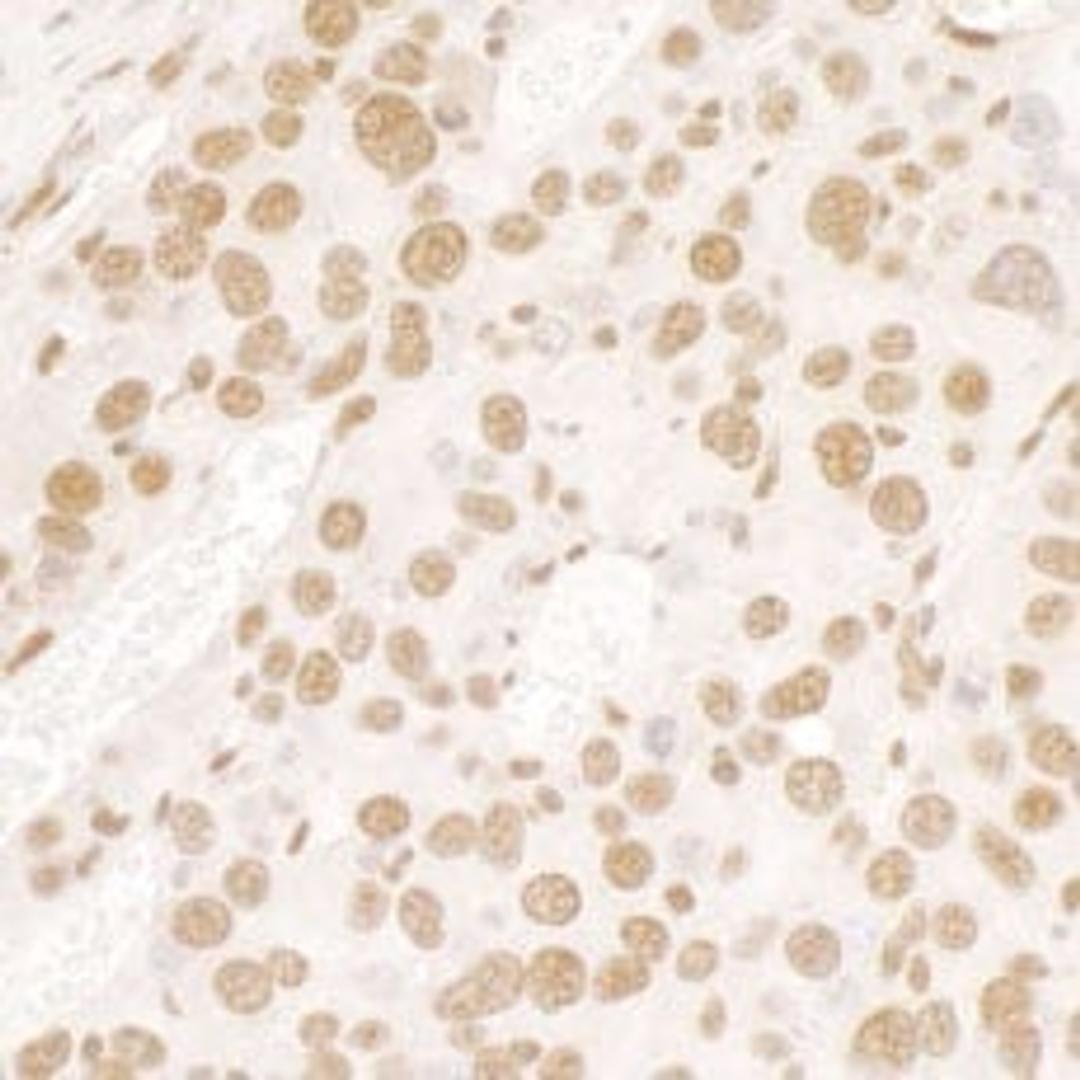 Detection of mouse FUS by immunohistochemistry.