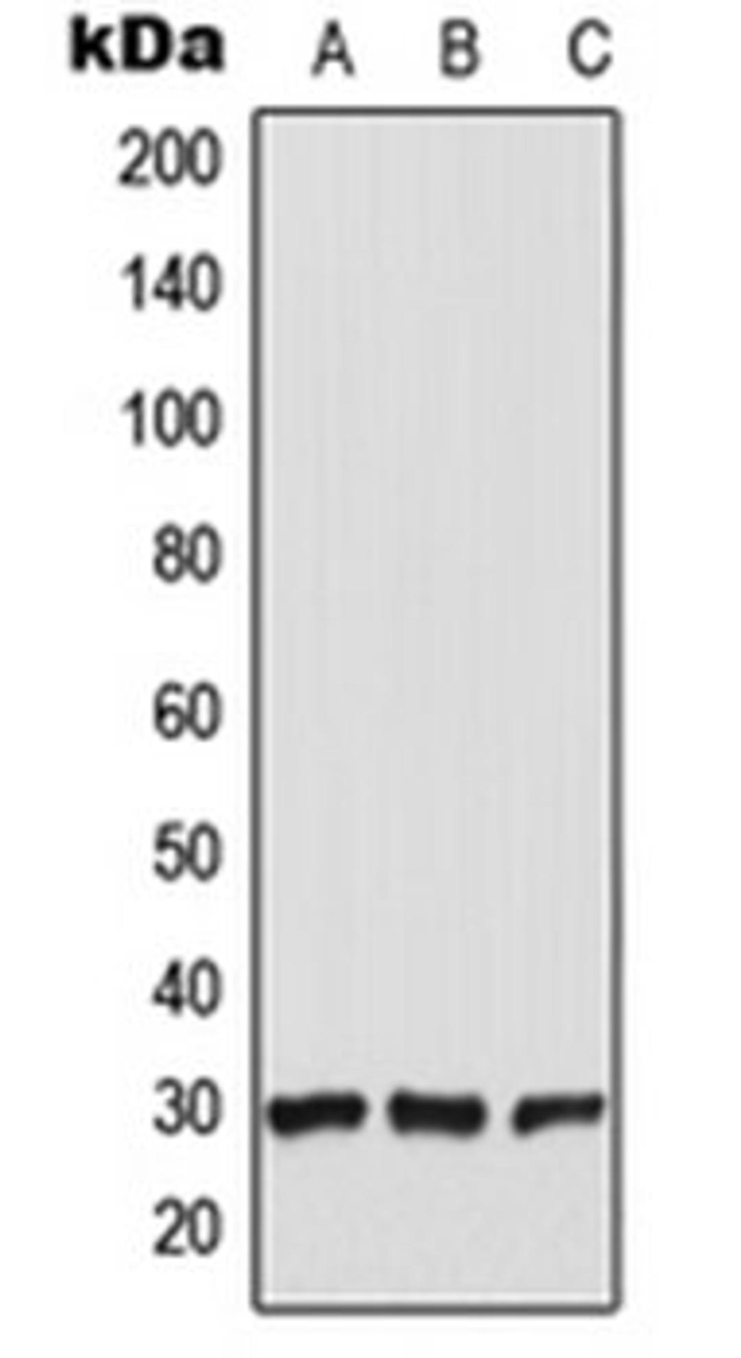 Western blot analysis of HEK293T (Lane 1), Raw264.7 (Lane 2), PC12 (Lane 3) whole cell lysates using CT47A1 antibody