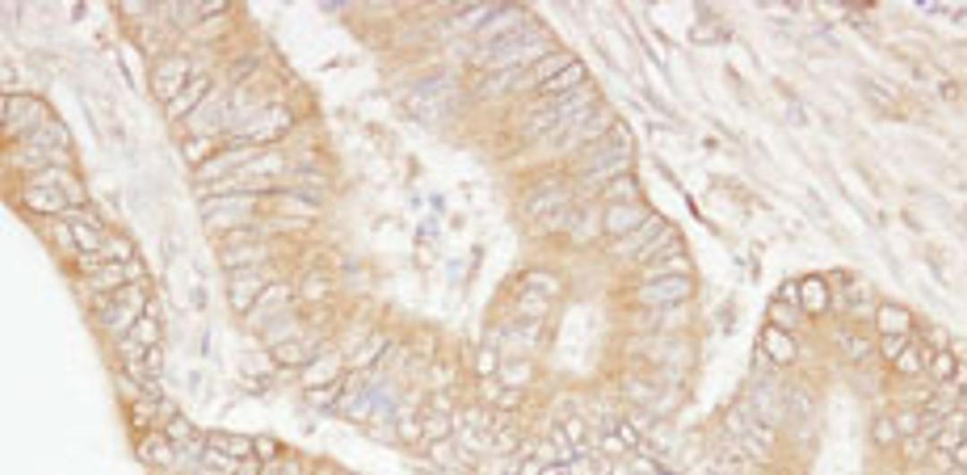 Detection of human USP5/IsoT by immunohistochemistry.