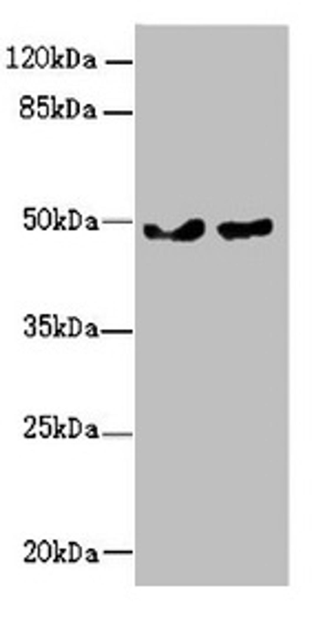 Western blot. All lanes: ZBTB25 antibody at 0.43µg/ml. Lane 1: MCF-7 whole cell lysate. Lane 2: Hela whole cell lysate. Secondary. Goat polyclonal to rabbit IgG at 1/10000 dilution. Predicted band size: 49 kDa. Observed band size: 49 kDa