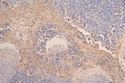 IHC image of CSB-RA004928MA1HU diluted at 1:200 and staining in paraffin-embedded human tonsil tissue performed on a Leica BondTM system. After dewaxing and hydration, antigen retrieval was mediated by high pressure in a citrate buffer (pH 6.0). Section was blocked with 10% normal goat serum 30min at RT. Then primary antibody (1% BSA) was incubated at 4°C overnight. The primary is detected by a Goat anti-human polymer IgG labeled by HRP and visualized using 0.05% DAB.