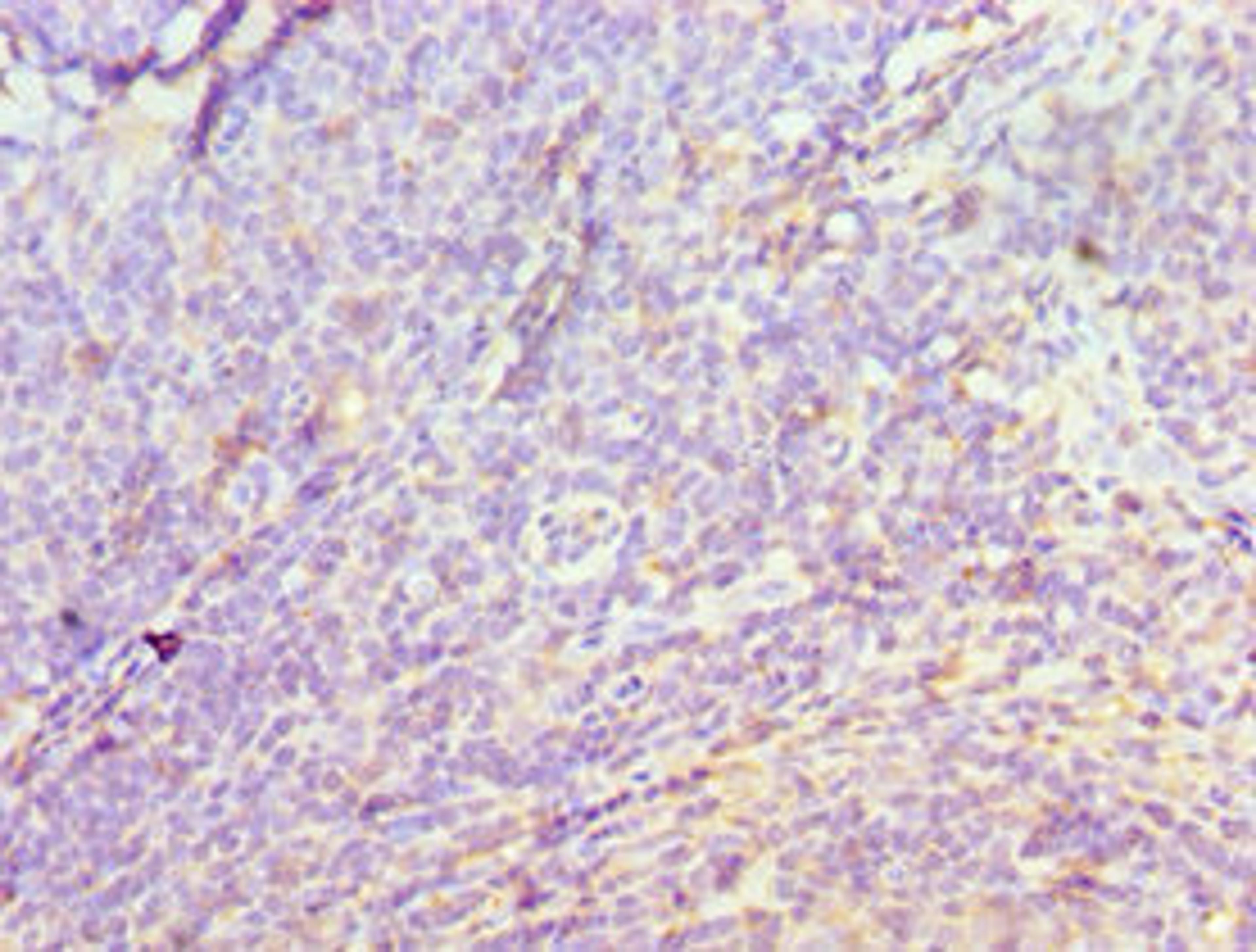 Immunohistochemistry of paraffin-embedded human tonsil tissue using CSB-PA887120ESR1HU at dilution of 1:100