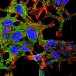 Immunofluorescence analysis of neuroblastoma cell line sk-n-be using Protocadherin Gamma A3 antibody