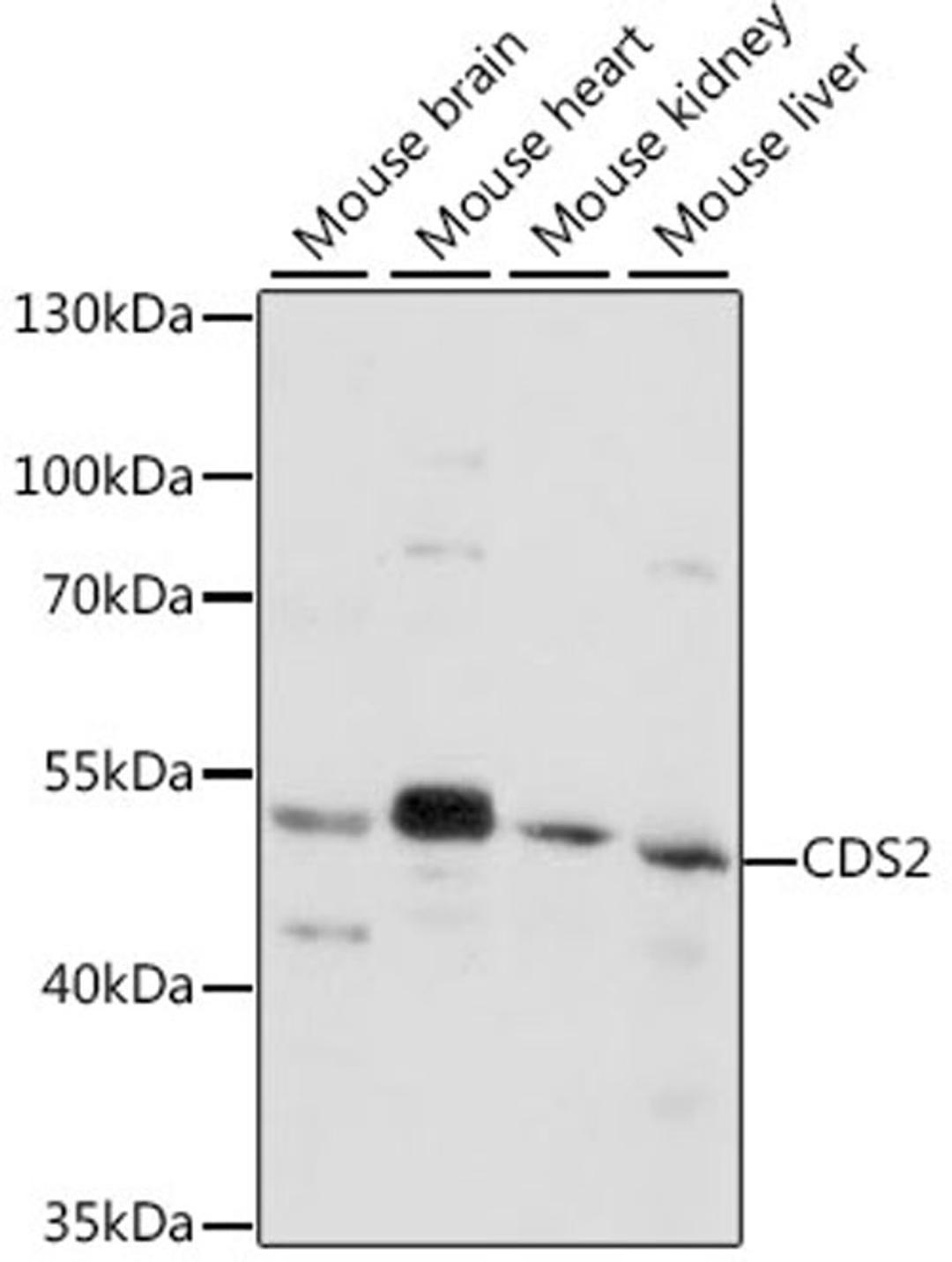 Western blot - CDS2 antibody (A16080)