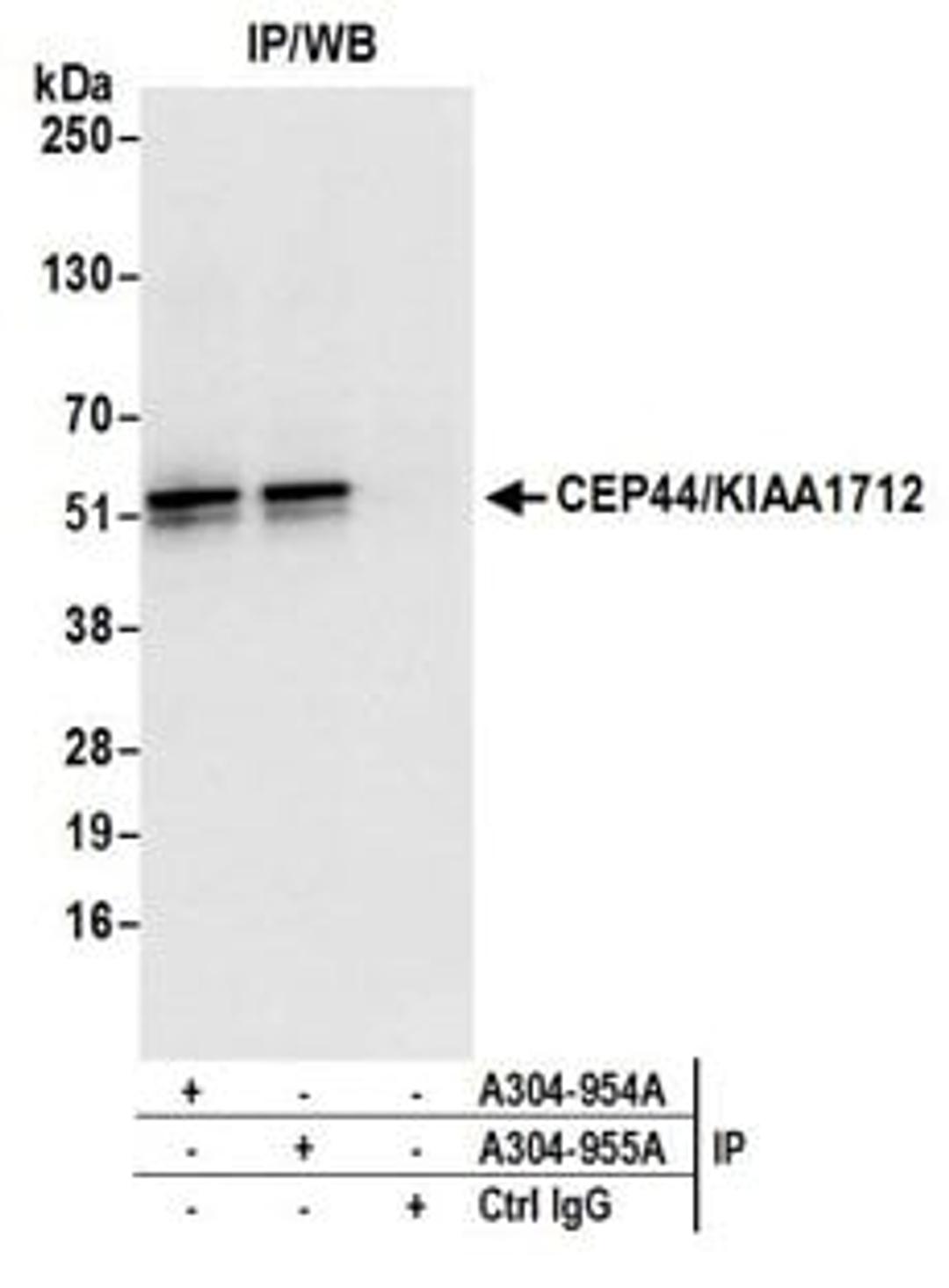 Detection of human CEP44/KIAA1712 by western blot of immunoprecipitates.