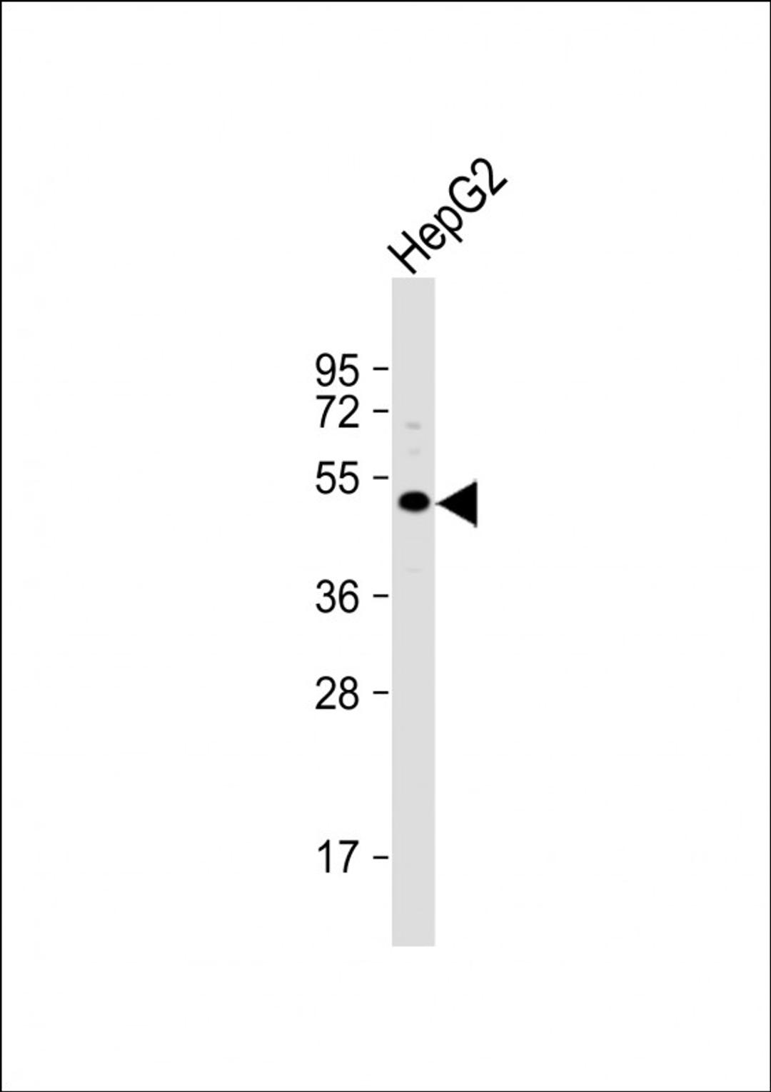 Western Blot at 1:1000 dilution + HepG2 whole cell lysate Lysates/proteins at 20 ug per lane.