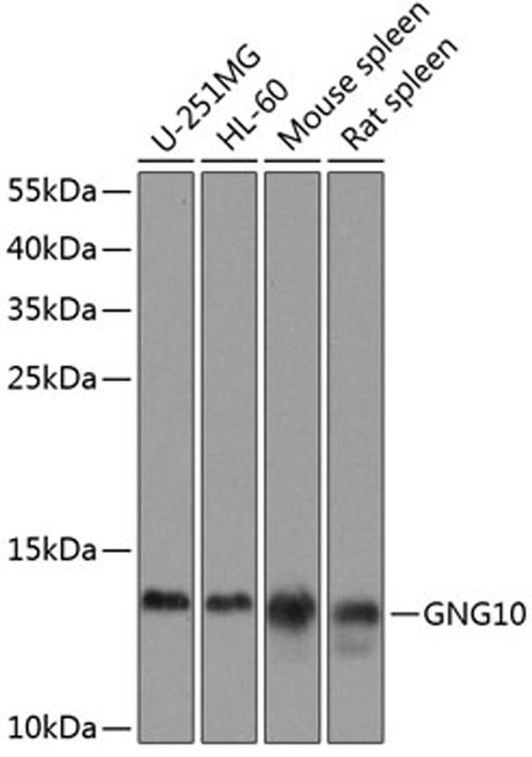 Western blot - GNG10 antibody (A8423)