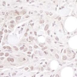 Detection of human Geminin by immunohistochemistry.