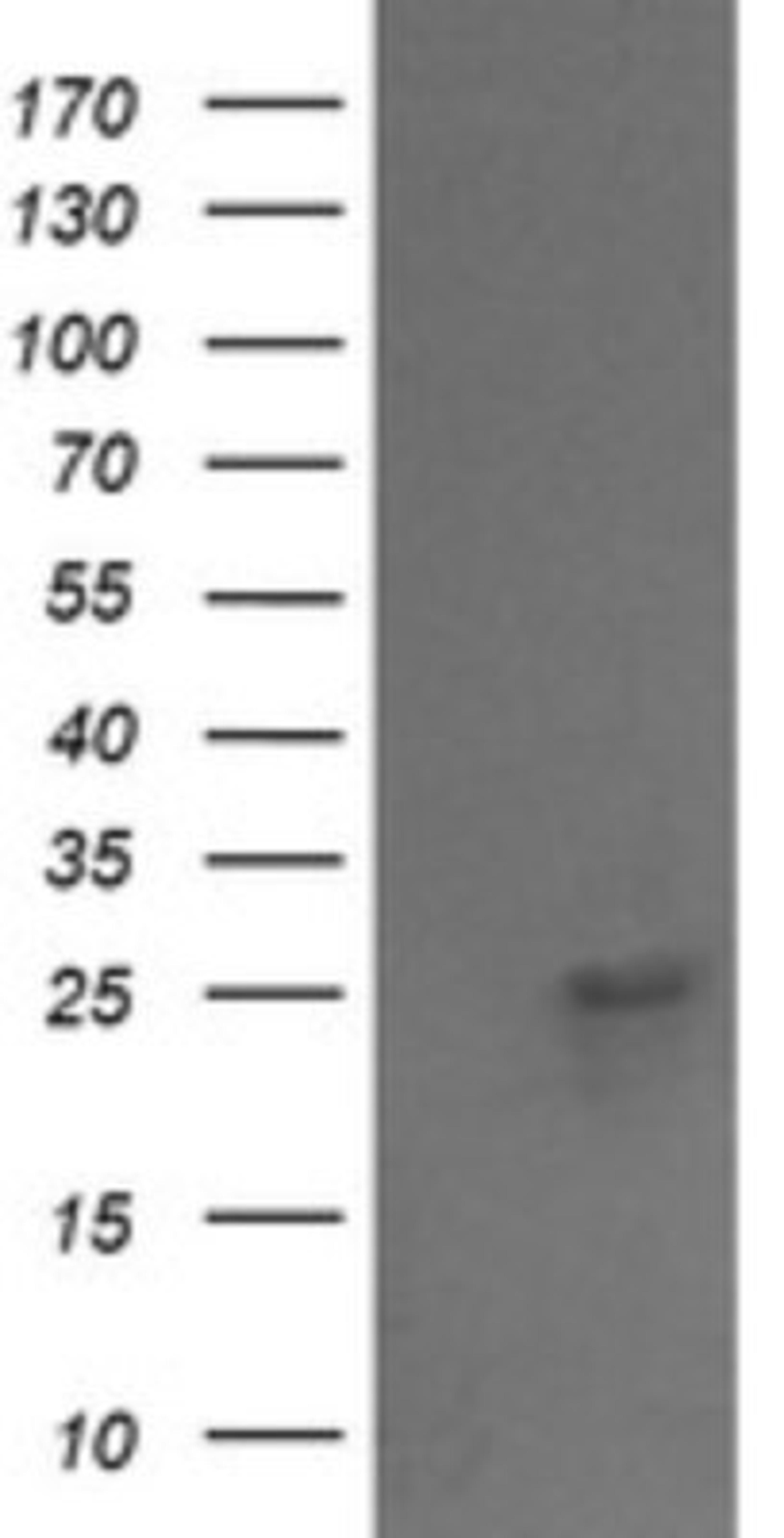 Western Blot: VPS28 Antibody (1A8) [NBP2-45412] - Analysis of HEK293T cells were transfected with the pCMV6-ENTRY control (Left lane) or pCMV6-ENTRY VPS28.