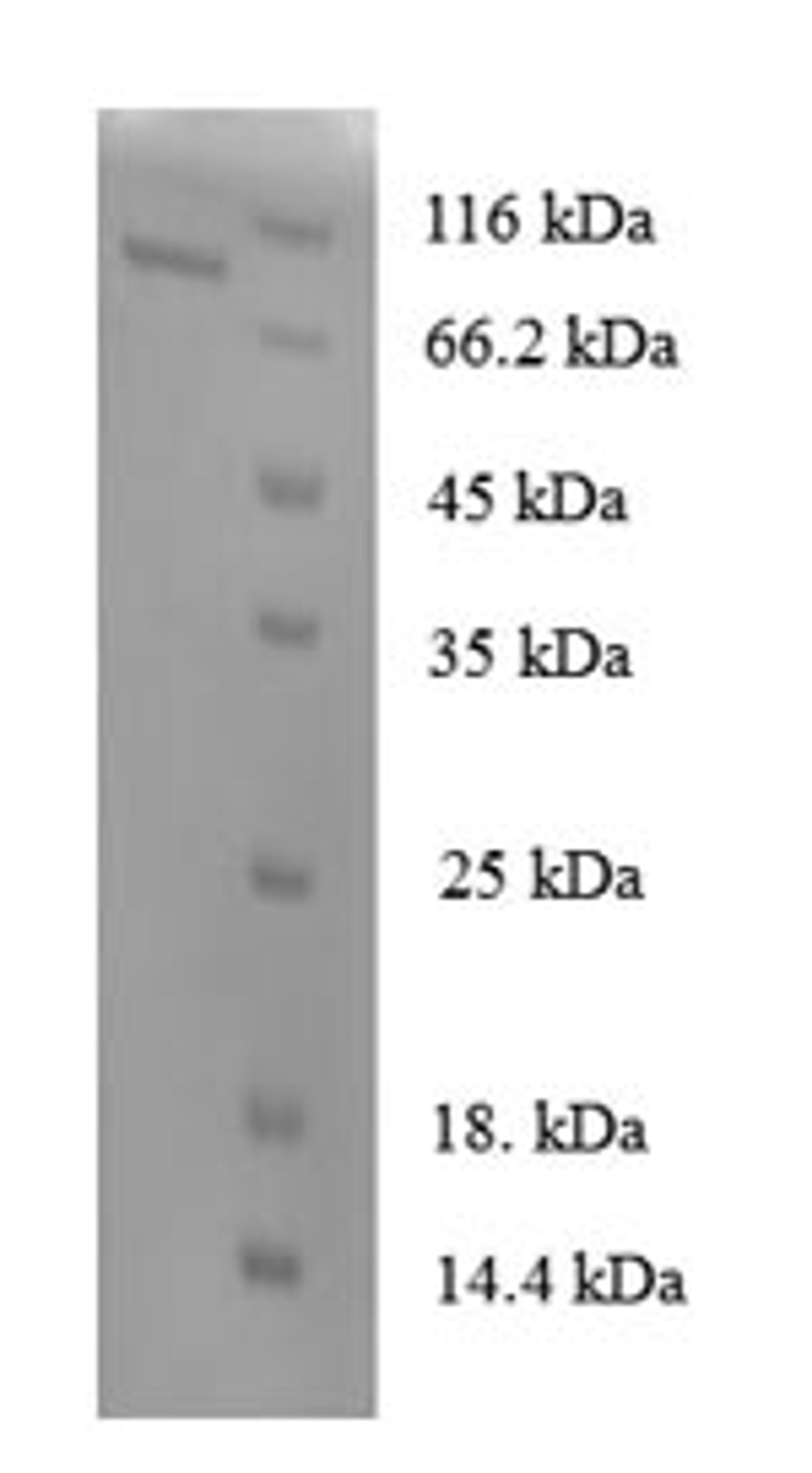 (Tris-Glycine gel) Discontinuous SDS-PAGE (reduced) with 5% enrichment gel and 15% separation gel.