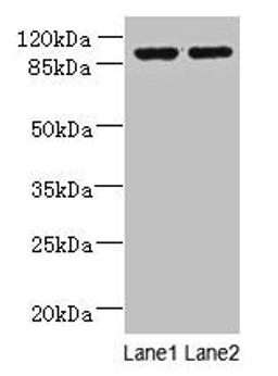 Western blot. All lanes: EFHB antibody at 4µg/ml. Lane 1: HepG2 whole cell lysate. Lane 2: PC-3 whole cell lysate. Secondary. Goat polyclonal to rabbit IgG at 1/10000 dilution. Predicted band size: 94, 71, 80 kDa. Observed band size: 94 kDa