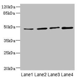 Western blot. All lanes: TTC5 antibody at 6µg/ml. Lane 1: HepG2 whole cell lysate. Lane 2: A549 whole cell lysate. Lane 3: MCF-7 whole cell lysate. Lane 4: Mouse kidney tissue. Secondary. Goat polyclonal to rabbit IgG at 1/10000 dilution. Predicted band size: 49 kDa. Observed band size: 49 kDa