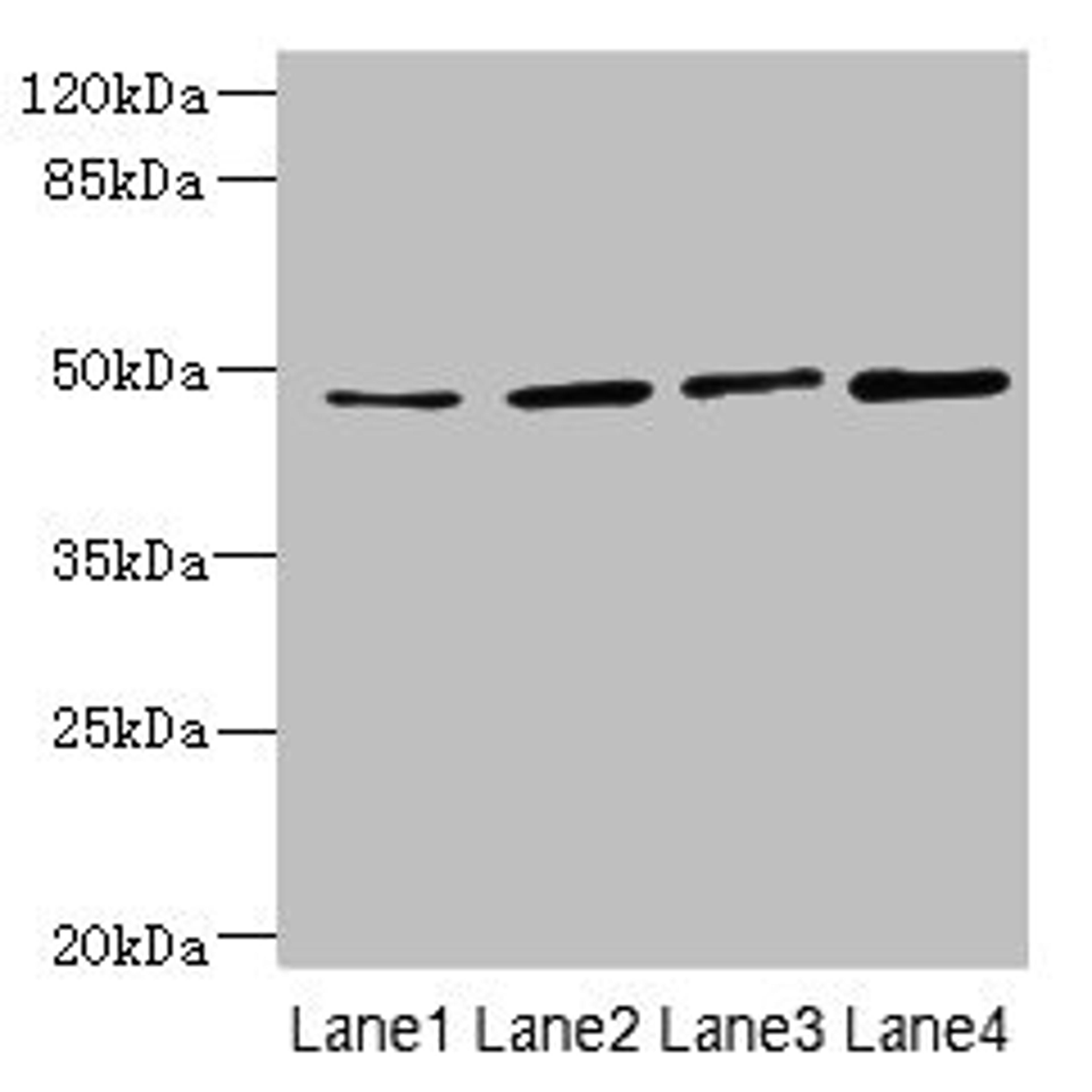 Western blot. All lanes: TTC5 antibody at 6µg/ml. Lane 1: HepG2 whole cell lysate. Lane 2: A549 whole cell lysate. Lane 3: MCF-7 whole cell lysate. Lane 4: Mouse kidney tissue. Secondary. Goat polyclonal to rabbit IgG at 1/10000 dilution. Predicted band size: 49 kDa. Observed band size: 49 kDa