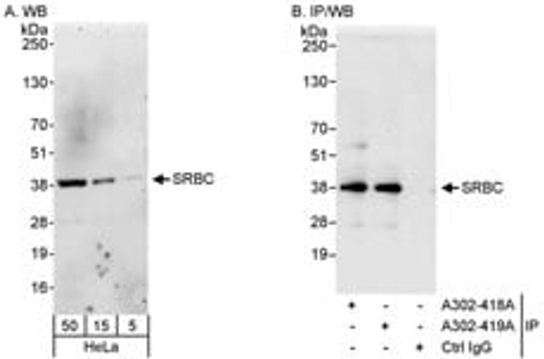 Detection of human SRBC by western blot and immunoprecipitation.