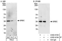 Detection of human SRBC by western blot and immunoprecipitation.