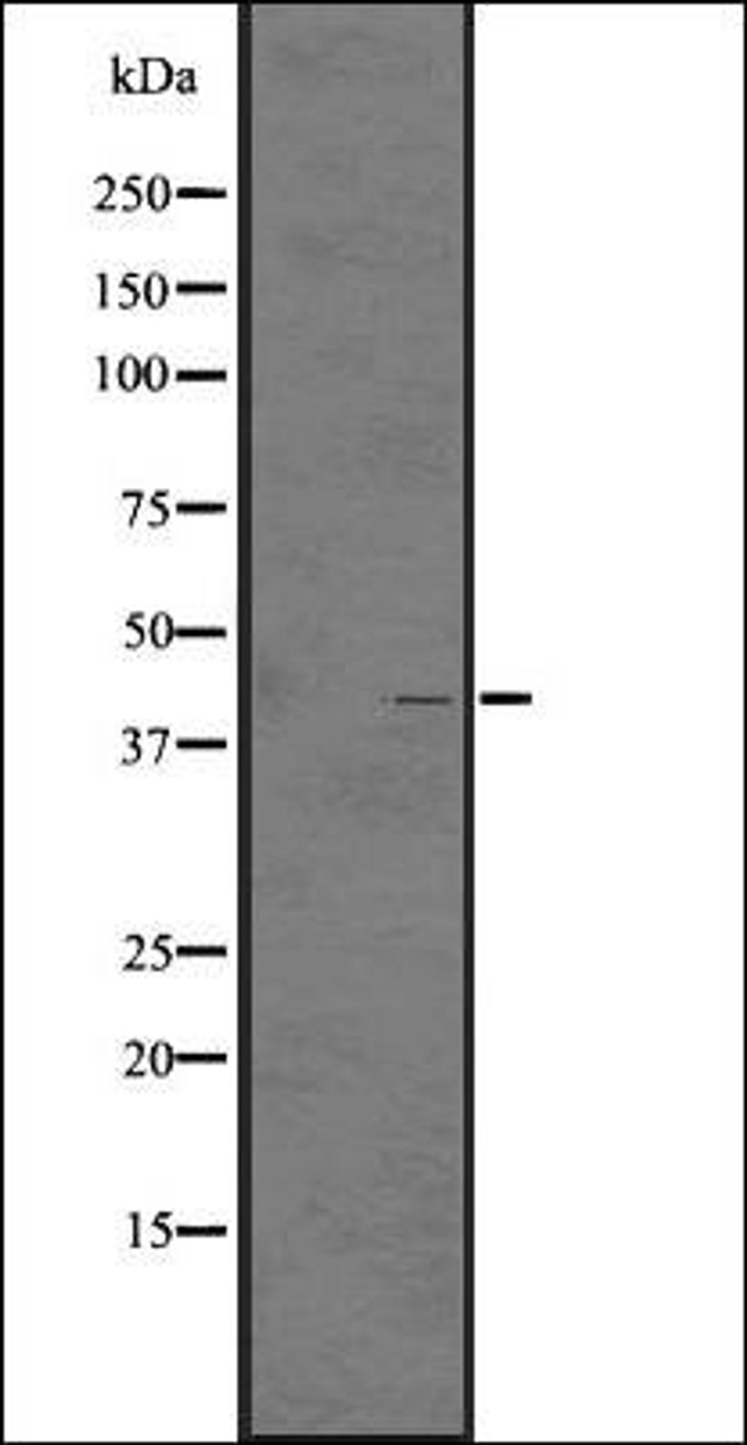 Western blot analysis of A431 whole cell lysate using GPR92/GPR93 antibody