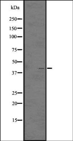 Western blot analysis of A431 whole cell lysate using GPR92/GPR93 antibody