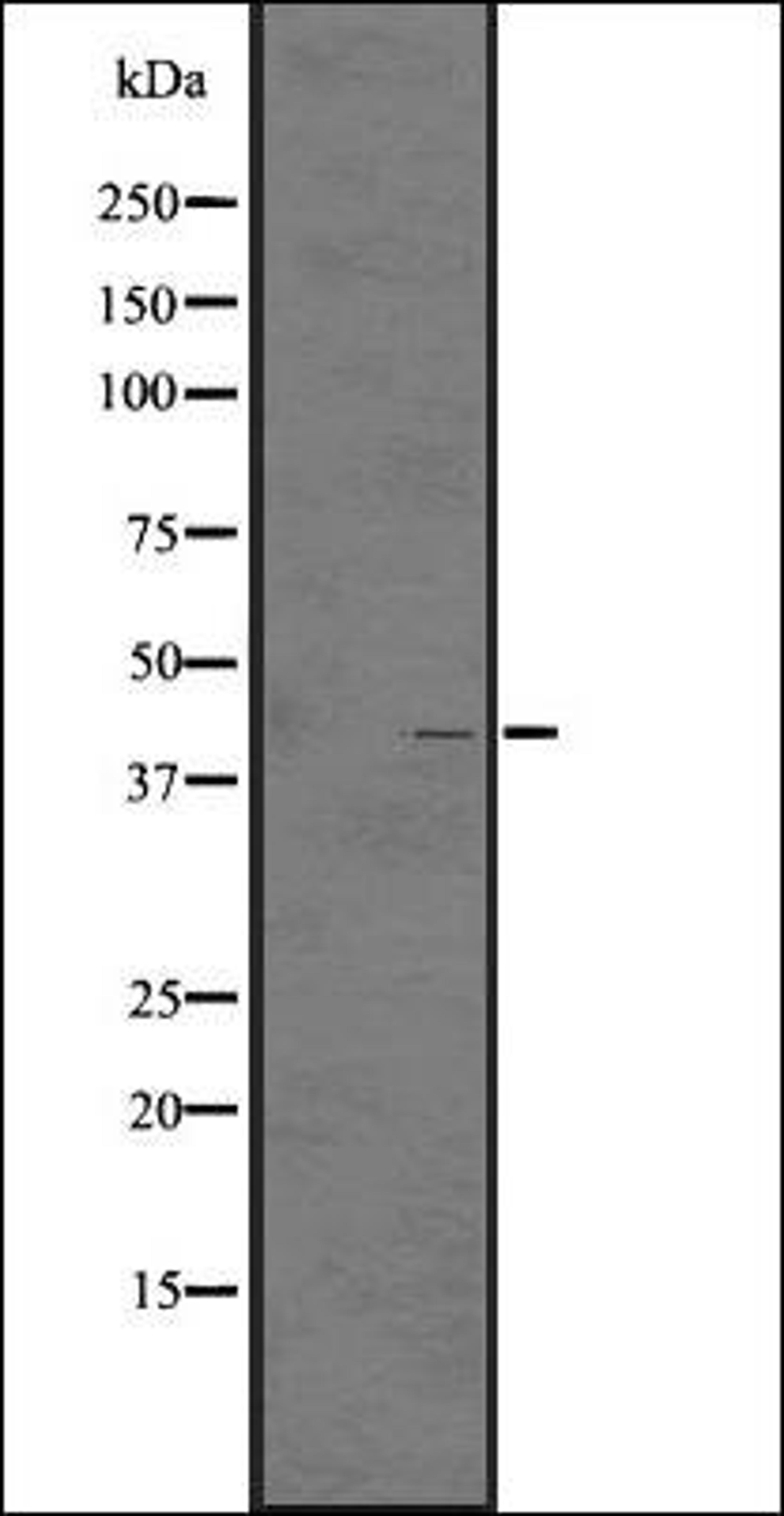 Western blot analysis of A431 whole cell lysate using GPR92/GPR93 antibody