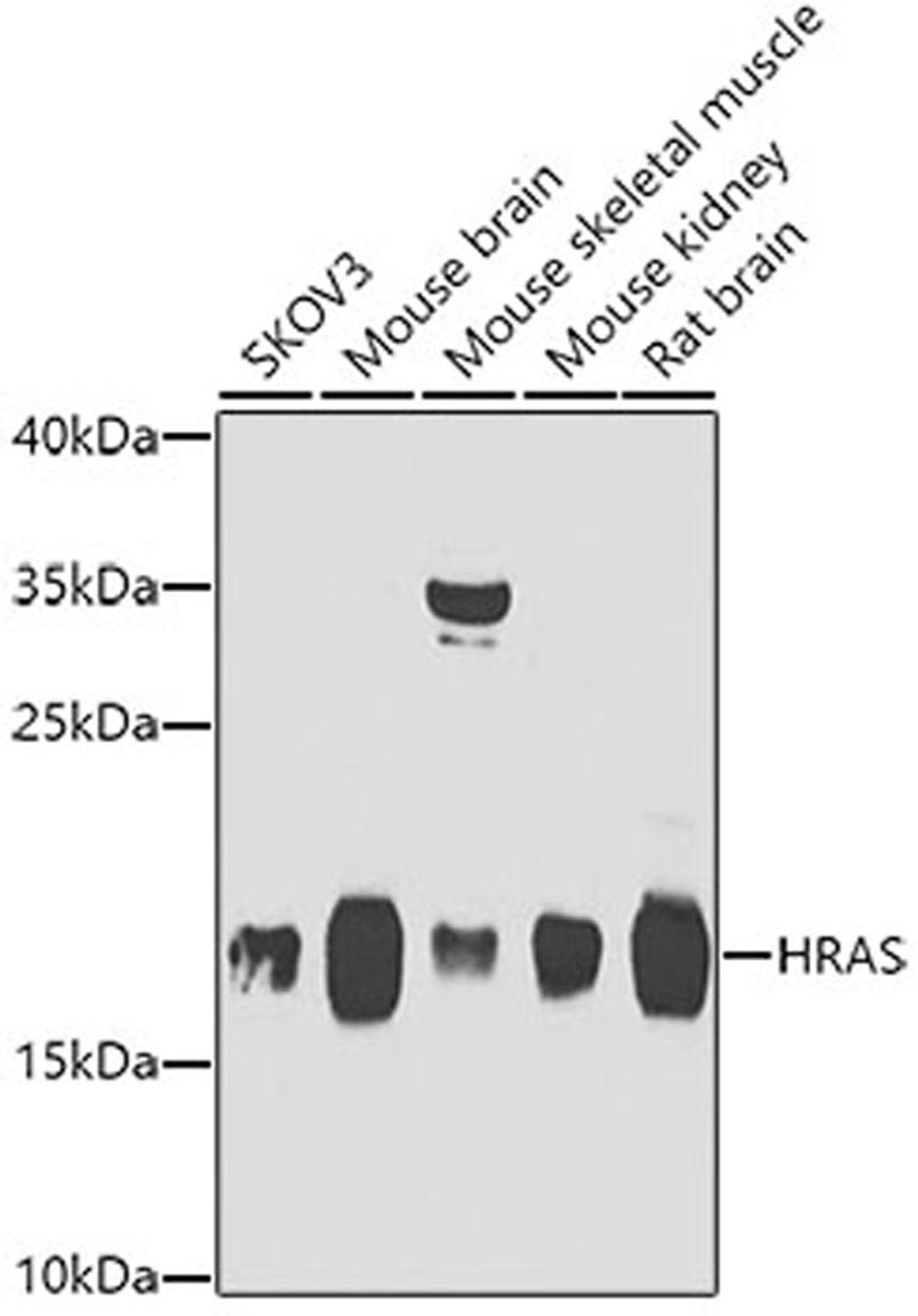 Western blot - HRAS antibody (A7901)