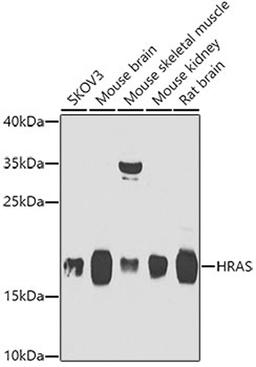 Western blot - HRAS antibody (A7901)