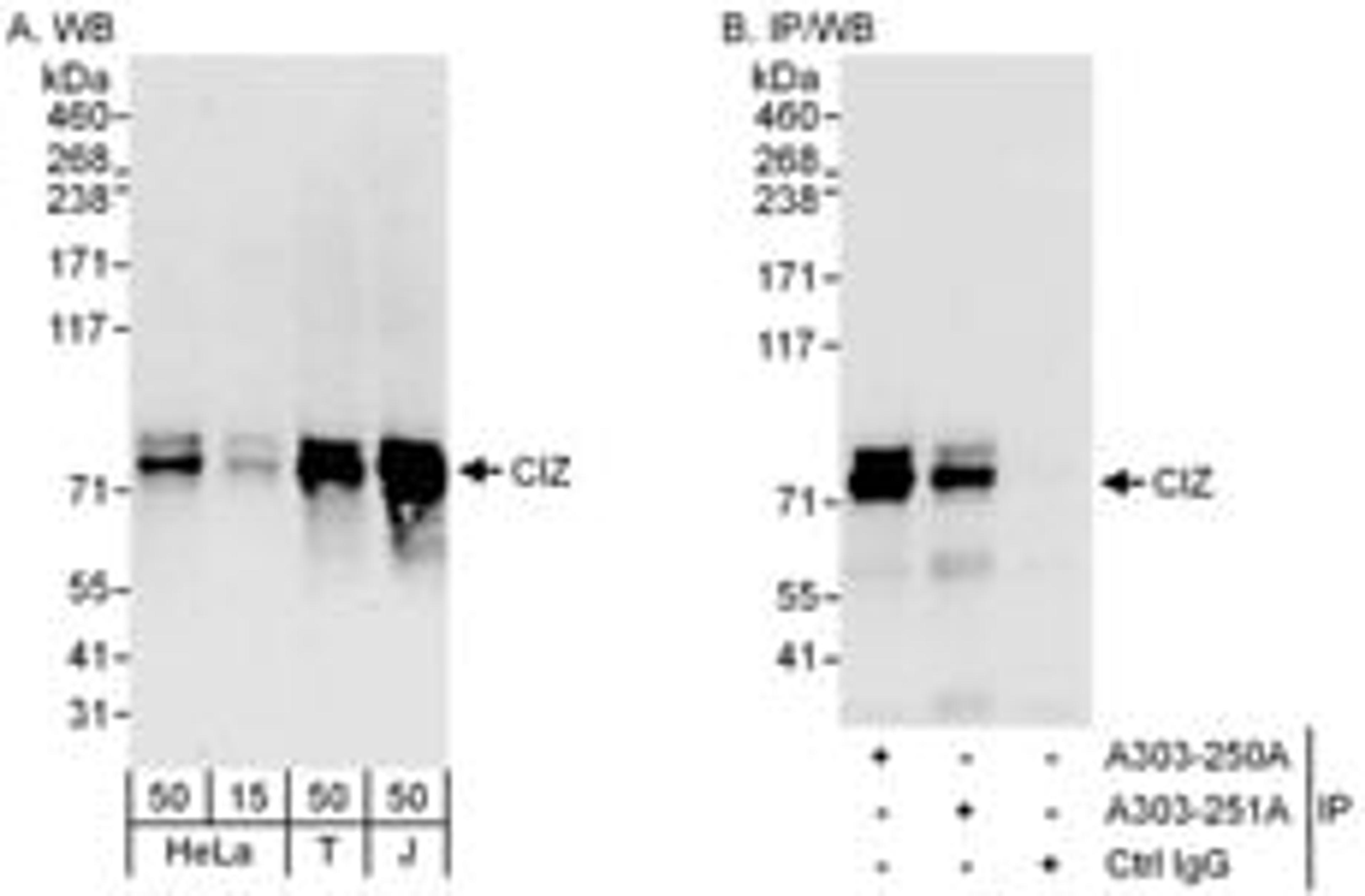 Detection of human CIZ by western blot and immunoprecipitation.