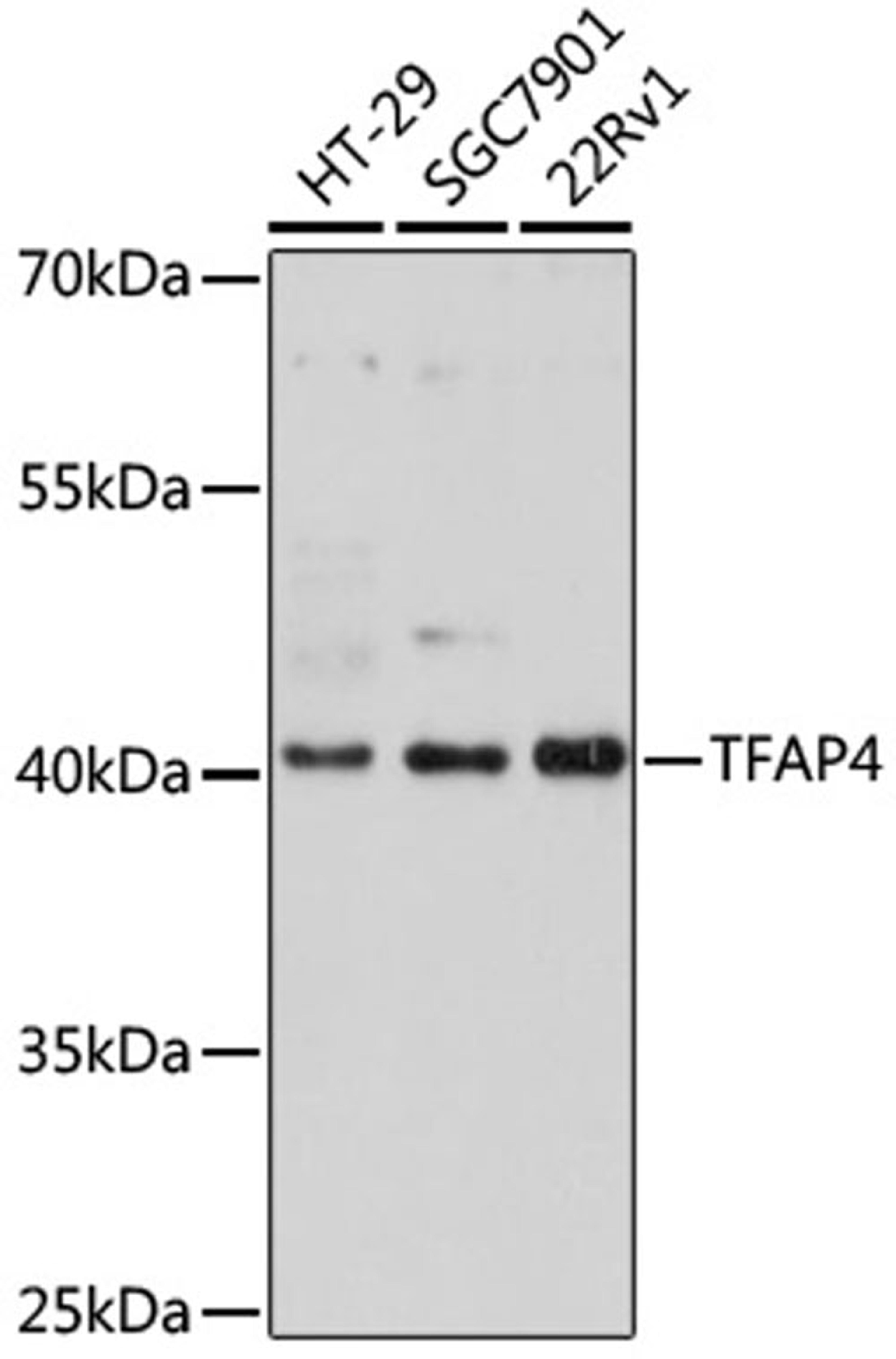 Western blot - TFAP4 antibody (A16727)