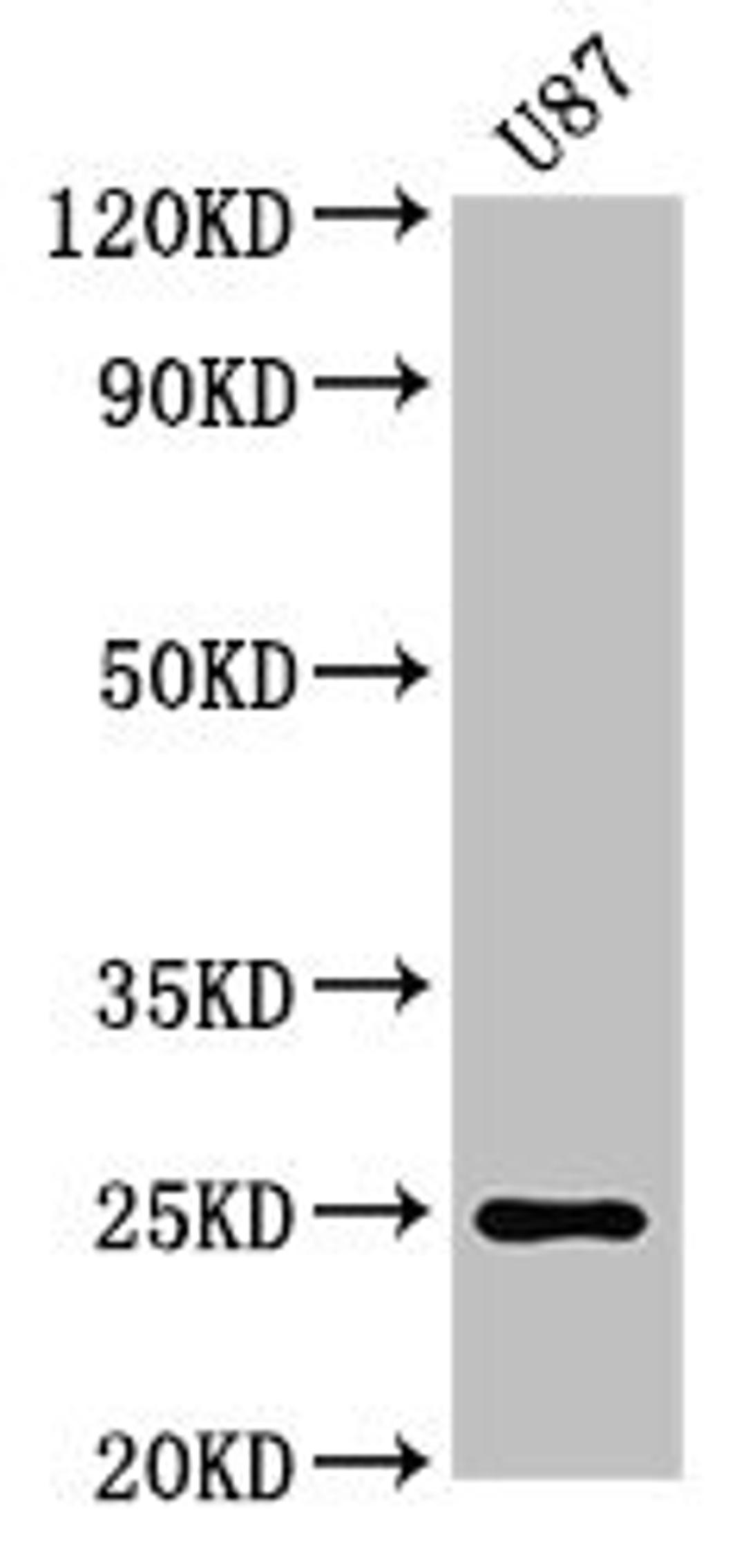 Western Blot. Positive WB detected in: U87 whole cell lysate. All lanes: RGS2 antibody at 3µg/ml. Secondary. Goat polyclonal to rabbit IgG at 1/50000 dilution. Predicted band size: 25, 24, 23, 21 kDa. Observed band size: 25 kDa