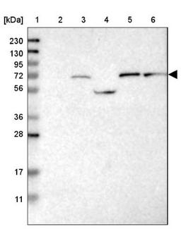 Western Blot: Guanylyl Cyclase beta 1 Antibody [NBP1-89784] - Lane 1: Marker [kDa] 230, 130, 95, 72, 56, 36, 28, 17, 11<br/>Lane 2: Human cell line RT-4<br/>Lane 3: Human cell line U-251MG sp<br/>Lane 4: Human plasma (IgG/HSA depleted)<br/>Lane 5: Human liver tissue<br/>Lane 6: Human tonsil tissue