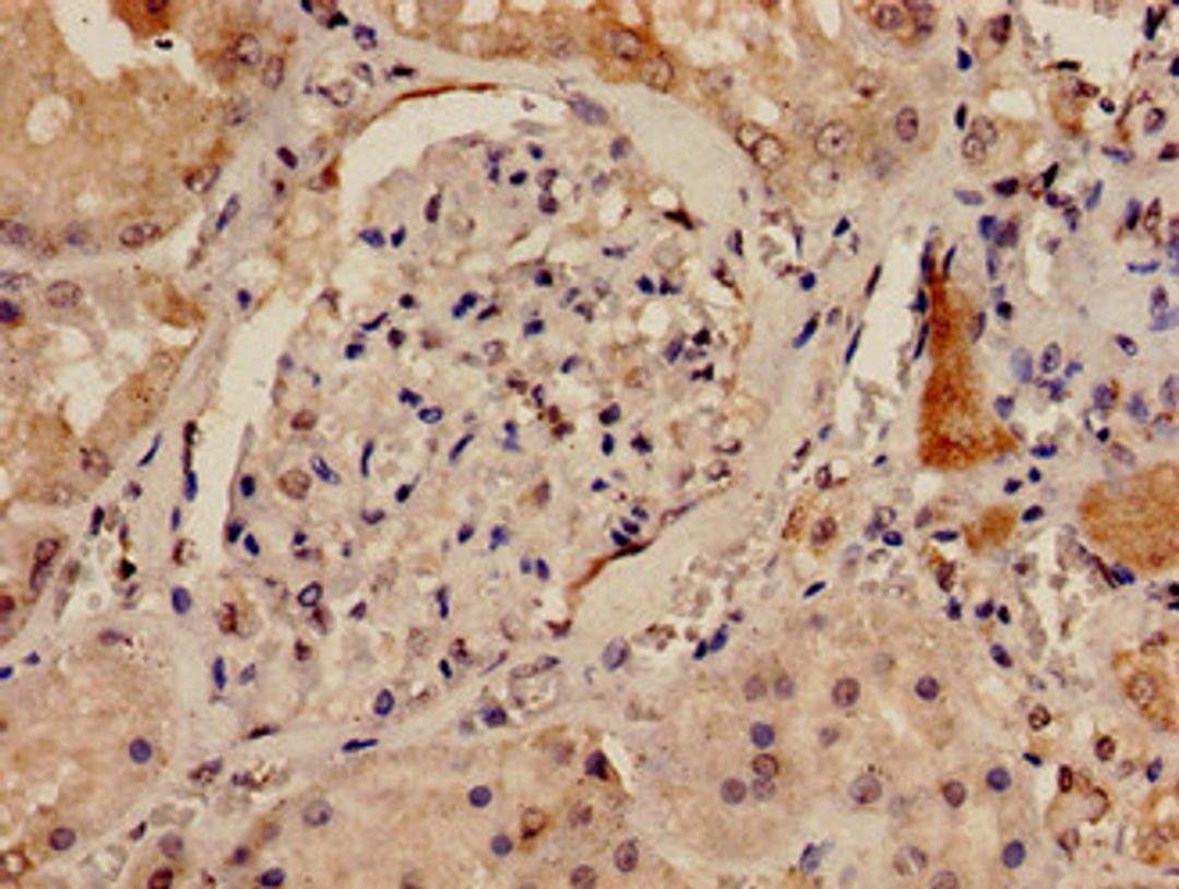Immunohistochemistry analysis of human kidney tissue using CSB-PA614264LA01HU at dilution of 1:100