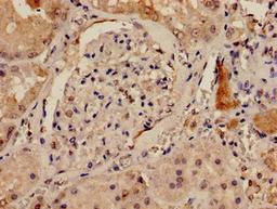 Immunohistochemistry analysis of human kidney tissue using CSB-PA614264LA01HU at dilution of 1:100