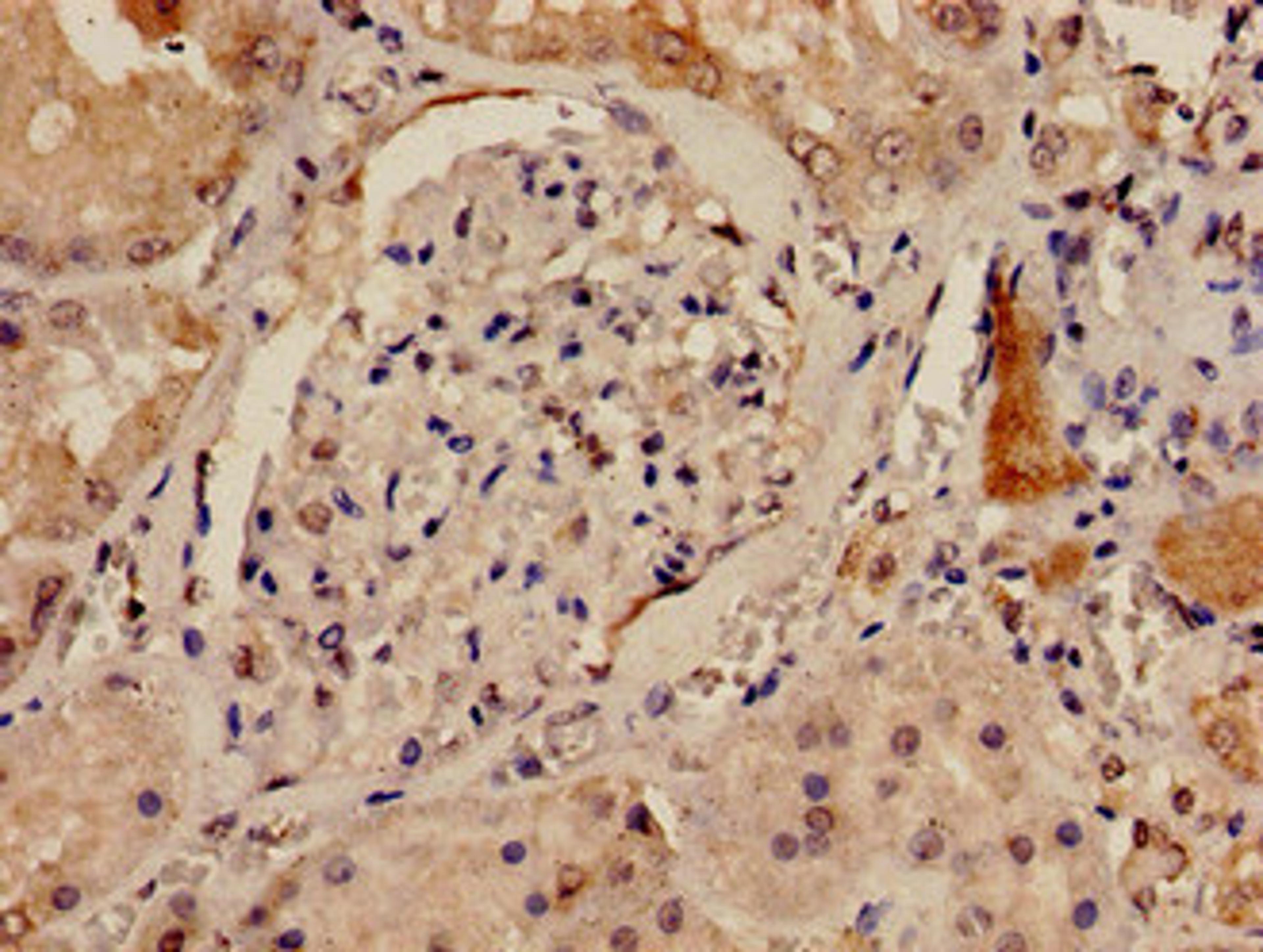 Immunohistochemistry analysis of human kidney tissue using CSB-PA614264LA01HU at dilution of 1:100