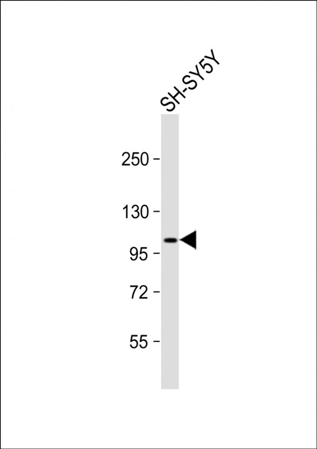 Western Blot at 1:1000 dilution + SH-SY5Y whole cell lysate Lysates/proteins at 20 ug per lane.