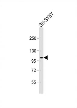 Western Blot at 1:1000 dilution + SH-SY5Y whole cell lysate Lysates/proteins at 20 ug per lane.