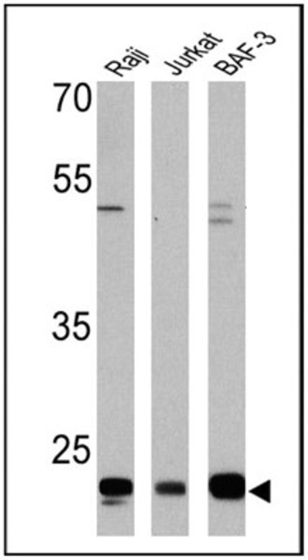 Western Blot: CD58/LFA-3 Antibody (TS2/9) [NBP2-22542] - Analysis of 25 ug of Raji (Lane 1), Jurkat (Lane 2), and BAF-3 cell lysates (Lane 3) and a molecular weight protein ladder.