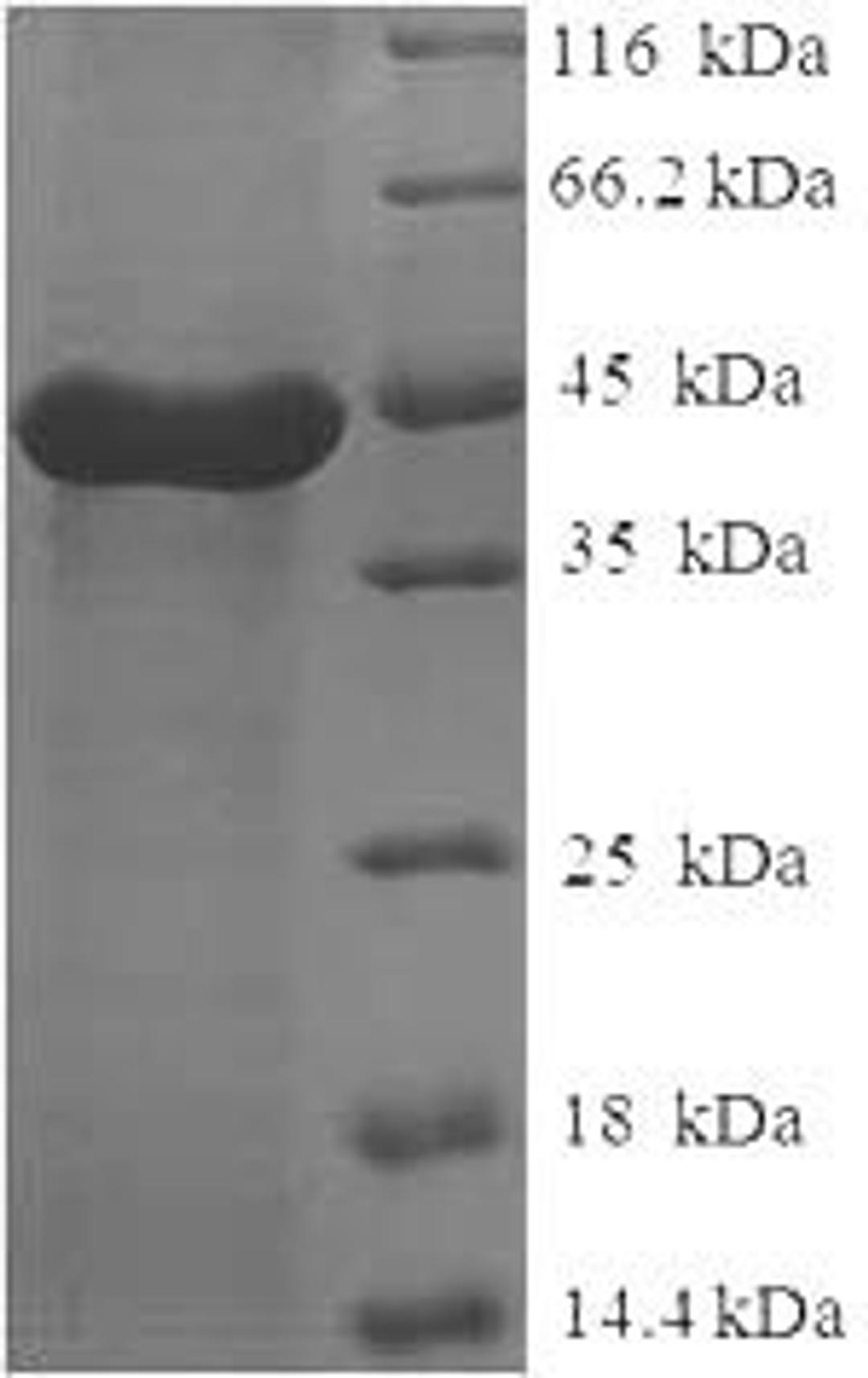 (Tris-Glycine gel) Discontinuous SDS-PAGE (reduced) with 5% enrichment gel and 15% separation gel.