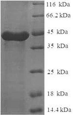 (Tris-Glycine gel) Discontinuous SDS-PAGE (reduced) with 5% enrichment gel and 15% separation gel.