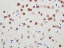 Immunohistochemistry: SMN Antibody (2B1) [NB100-1936] - Immunohistochemical analysis of SMN on mouse brain using NB100-1936.