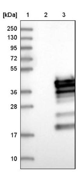 Western Blot: RCAN3 Antibody [NBP1-84972] - Lane 1: Marker [kDa] 250, 130, 95, 72, 55, 36, 28, 17, 10<br/>Lane 2: Negative control (vector only transfected HEK293T lysate)<br/>Lane 3: Over-expression lysate (Co-expressed with a C-terminal myc-DDK tag (~3.1 kDa) in mammalian HEK293T cells, LY415541)