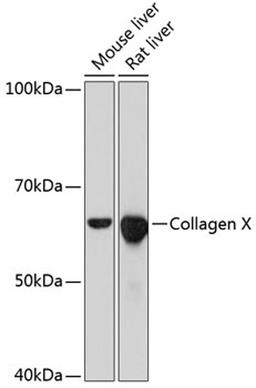 Western blot - Collagen X Rabbit mAb (A11645)