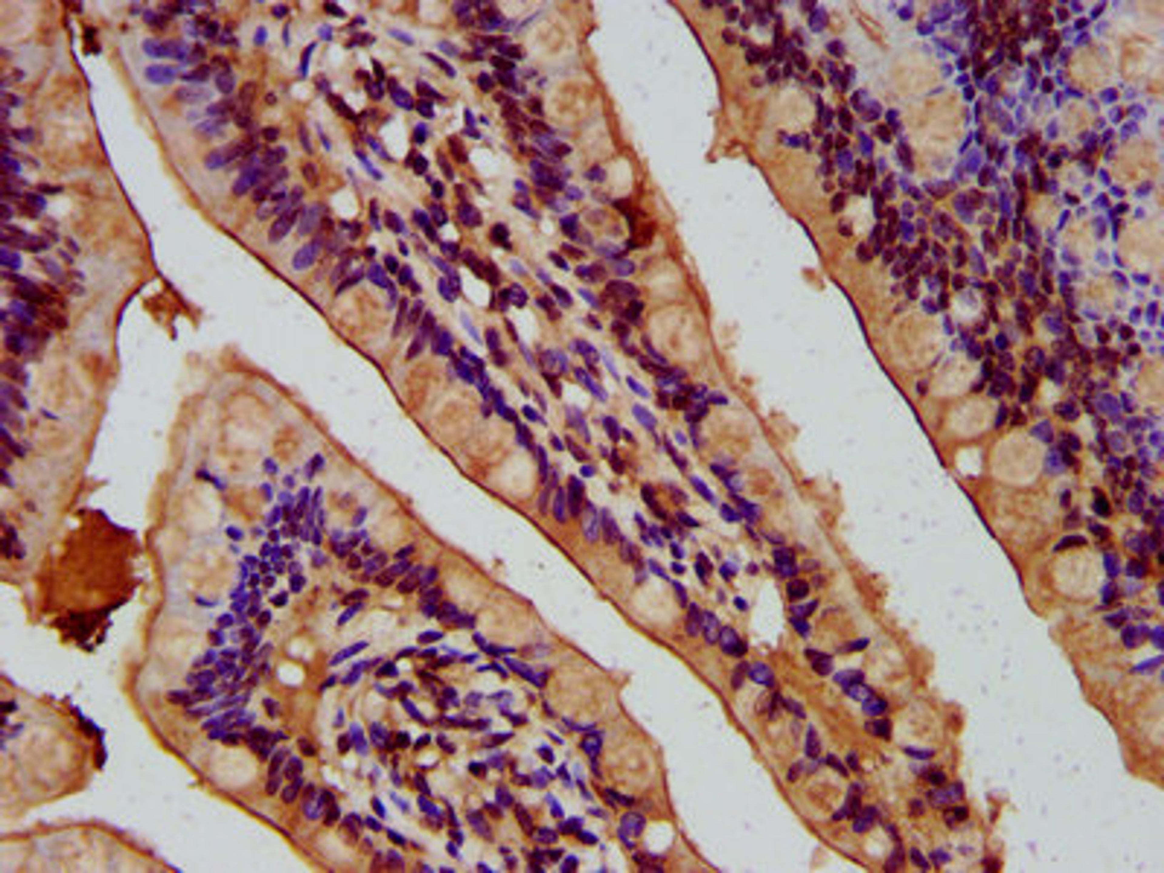IHC image of CSB-PA848831LA01HU diluted at 1:400 and staining in paraffin-embedded human small intestine tissue performed on a Leica BondTM system. After dewaxing and hydration, antigen retrieval was mediated by high pressure in a citrate buffer (pH 6.0). Section was blocked with 10% normal goat serum 30min at RT. Then primary antibody (1% BSA) was incubated at 4°C overnight. The primary is detected by a biotinylated secondary antibody and visualized using an HRP conjugated SP system.