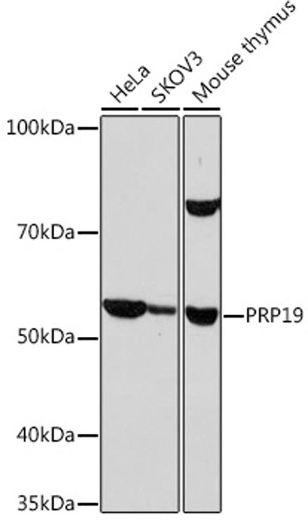 Western blot - PRP19 Rabbit mAb (A9660)